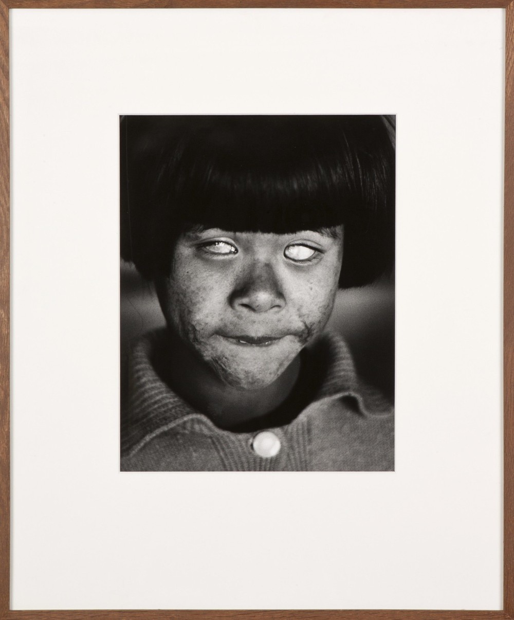 The blind girl of Hiroshima