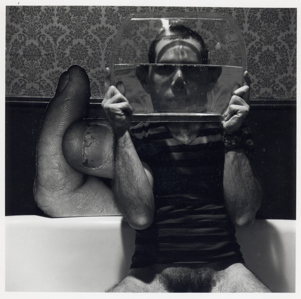 Self-portrait (with finger disease)